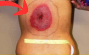 8 Alarming Skin Signs You Can’t Ignore!